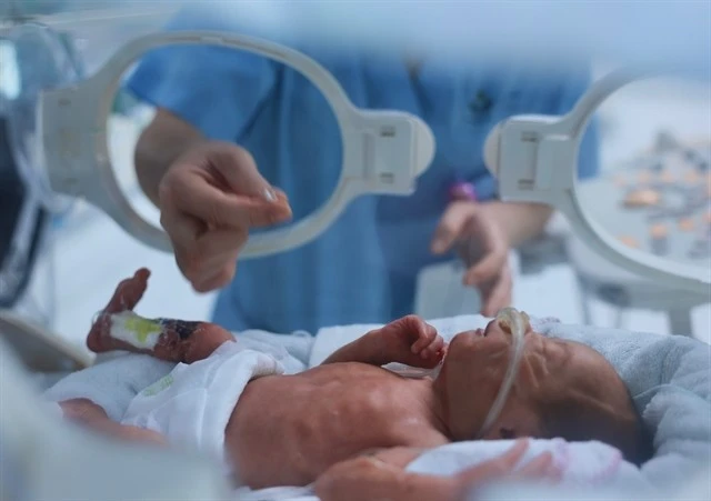 A newborn lying in an incubator at the Vietnam National Children's Hospital (Photo: VNA) 