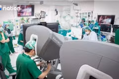 The first two robot-assisted heart surgeries in Thailand’s public health system performed at Rajavithi Hospital. (Photo: nationthailand.com)