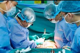 Doctors perform a kidney transplant for a patient with end-stage renal disease. (Photo: VietnamPlus)