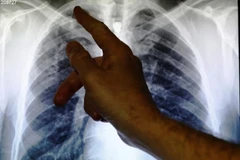 Illustrative photo: Reuters