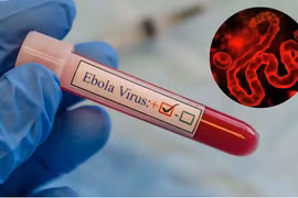 Ho Chi Minh City steps up surveillance to prevent Ebola risk