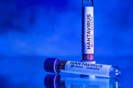 The designation covers both Hantavirus Pulmonary Syndrome and Hemorrhagic Fever with Renal Syndrome. (Photo: AFP)