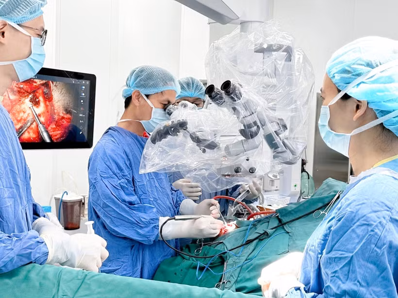 Dr. Nguyen Thanh Xuan is performing brain surgery on a patient (Photo published by VNA)