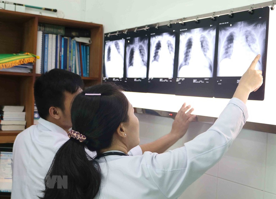 Doctors at Ho Chi Minh City’s Cho Ray hospital check Chinese patient Li Ding’s lung condition, January 30 (Photo: VNA)