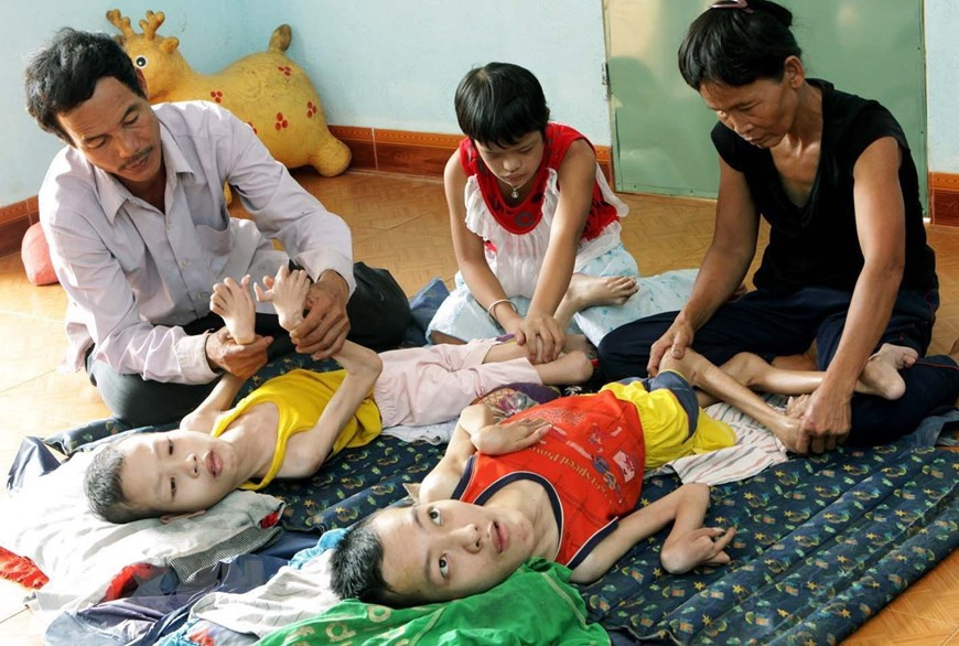 Taking care of Agent Orange and dioxin children in Tien Chau commune, Tien Phuoc distict, Quang Nam province (Photo:VNA)