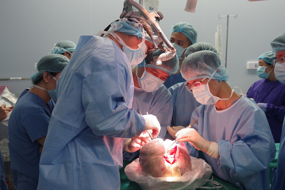 Doctors carry out lung transplant (Photo: VNA)