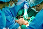 A surgery performed by doctors of Ho Chi Minh City University of Medicine and Pharmacy Hospital (Photo: VNA)