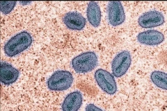 Mpox, caused by the monkeypox virus, is transmitted mainly through intimate or prolonged physical contact, said the Singapore's Communicable Diseases Agency. (Photo: straitstimes.com) 