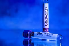 The designation covers both Hantavirus Pulmonary Syndrome and Hemorrhagic Fever with Renal Syndrome. (Photo: AFP)