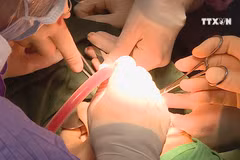 Surgeons bring back smiles to kids