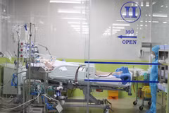 Ventilators witness huge difference in prices