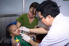 Children with facial deformities to receive free check-ups, surgerical operations