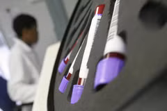 Malaysia reports sharp drop in new HIV infections