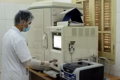 Increase in drug-resistant TB in southwest