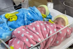 Twins survive after premature birth, weighing just 500g