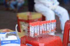 Vietnam improves SARS-CoV-2 testing capacity