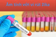 No Zika cases found in Vietnam as of March 18 