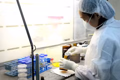 Antimicrobial resistance week to be launched nationwide 
