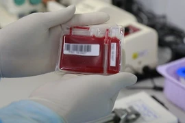 National hematology institute expands stem cell collection services