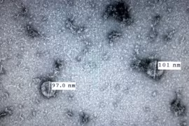 Vietnam successfully isolates new coronavirus: health official