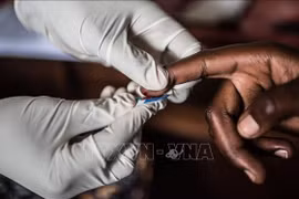Brunei provides free HIV screening until year end