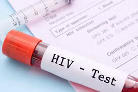 New strategy needed to improve HIV treatment quality