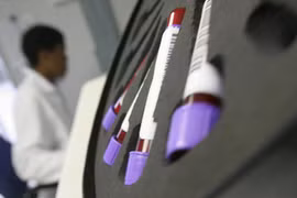 Malaysia reports sharp drop in new HIV infections