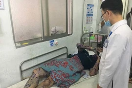 City export zone reports outbreak of chickenpox