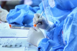 COVID-19: 77,982 cases recorded on February 26
