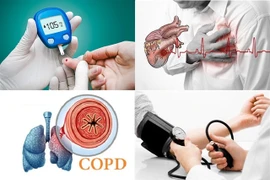Public awareness key to reducing risks associated with NCDs