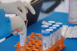 Vietnam reports 248 new COVID-19 infections