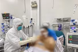 HCM City exerts efforts in providing treatment for critical COVID-19 cases