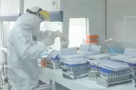 New COVID-19 cases drop strongly on September 28