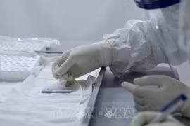 COVID-19: 159 new cases recorded in 12 hours