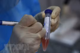 Two more COVID-19-related deaths confirmed