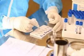 COVID-19: One imported, 93 domestic infections reported in 12 hours