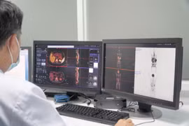 A PET/CT scan image of a patient at Cho Ray Hospital in HCM City (Photo: VNA)