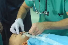 A cleft lip surgery (Photo: VNA)