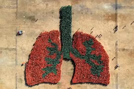 Philippines sets Guinness record for largest human image of an organ