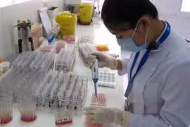 Stem cell industry necessary: expert 