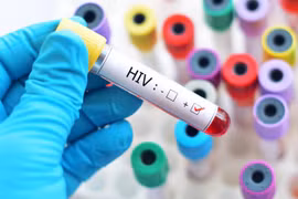Hanoi has country’s second highest rate of HIV/AIDS