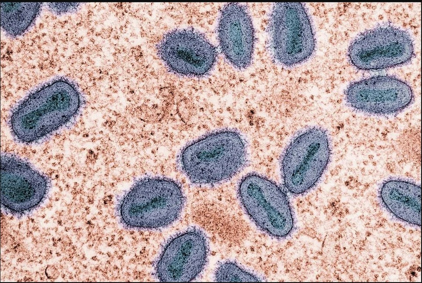 Mpox, caused by the monkeypox virus, is transmitted mainly through intimate or prolonged physical contact, said the Singapore's Communicable Diseases Agency. (Photo: straitstimes.com) 