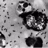 The bacterium Yersinia pestis causes plague, with bubonic plague being the most common form. Photo: US Centres for Disease Control and Prevention (CDC)