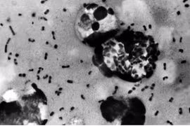 The bacterium Yersinia pestis causes plague, with bubonic plague being the most common form. Photo: US Centres for Disease Control and Prevention (CDC)