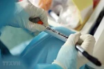About 30 labs in Vietnam capable of testing for COVID-19