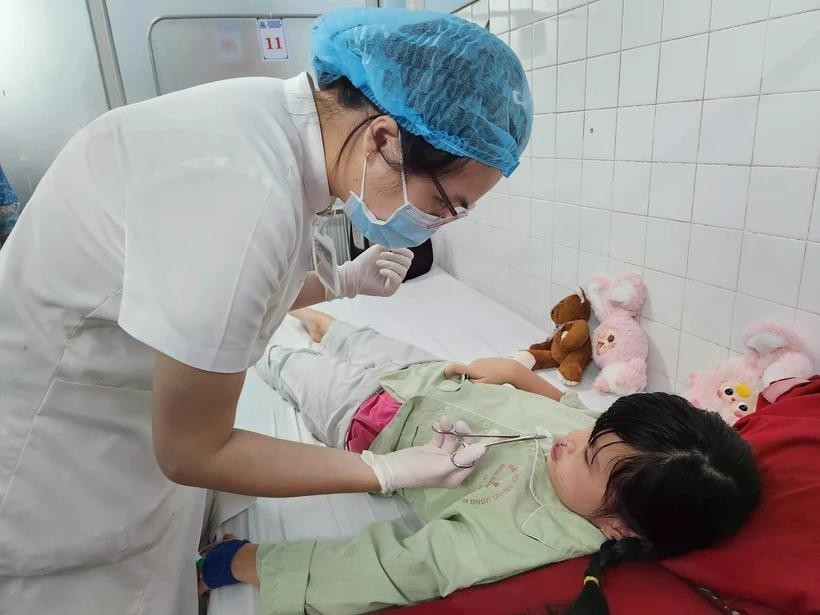 In Vietnam, approximately one in every 700–800 children is born with this condition. (Photo: VNA)