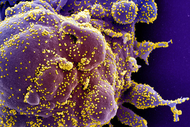 Human trials of COVID-19 vaccine to start soon in Thailand ảnh 1 Human trials of COVID-19 vaccine to start soon in Thailand ảnh 1