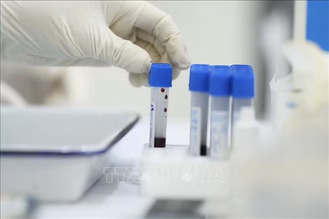 First community Omicron case recorded in Hanoi ảnh 2