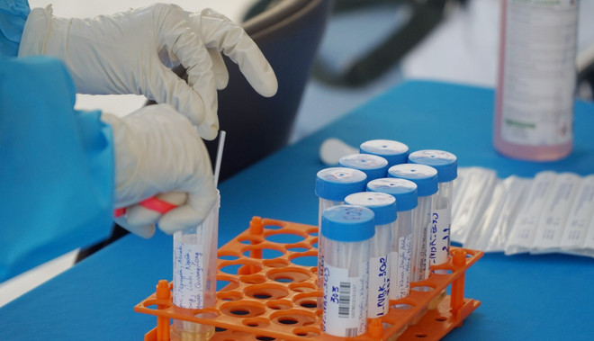 Vietnam reports 248 new COVID-19 infections ảnh 1 Vietnam reports 248 new COVID-19 infections ảnh 1