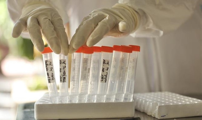 Vietnam’s COVID-19 infections surpass 23,300 ảnh 1 Vietnam’s COVID-19 infections surpass 23,300 ảnh 1